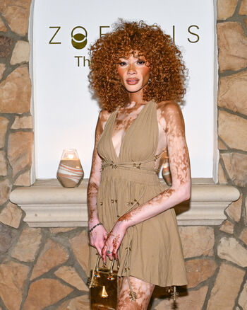 Winnie Harlow