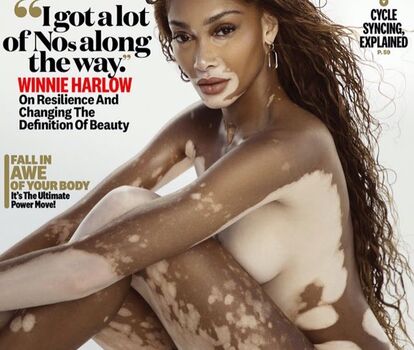 winnieharlow